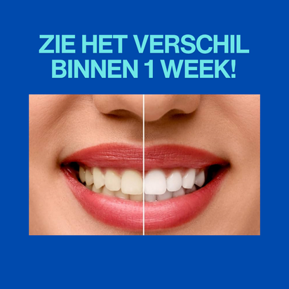Stralende Glimlach Whitening Strips