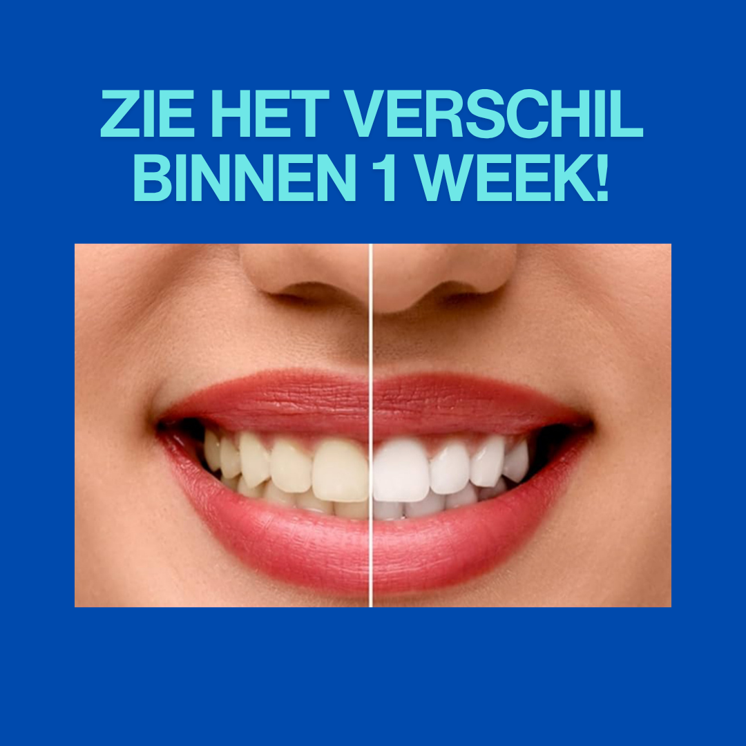 Stralende Glimlach Whitening Strips