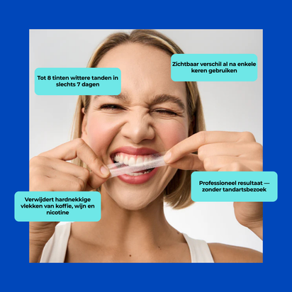 Stralende Glimlach Whitening Strips
