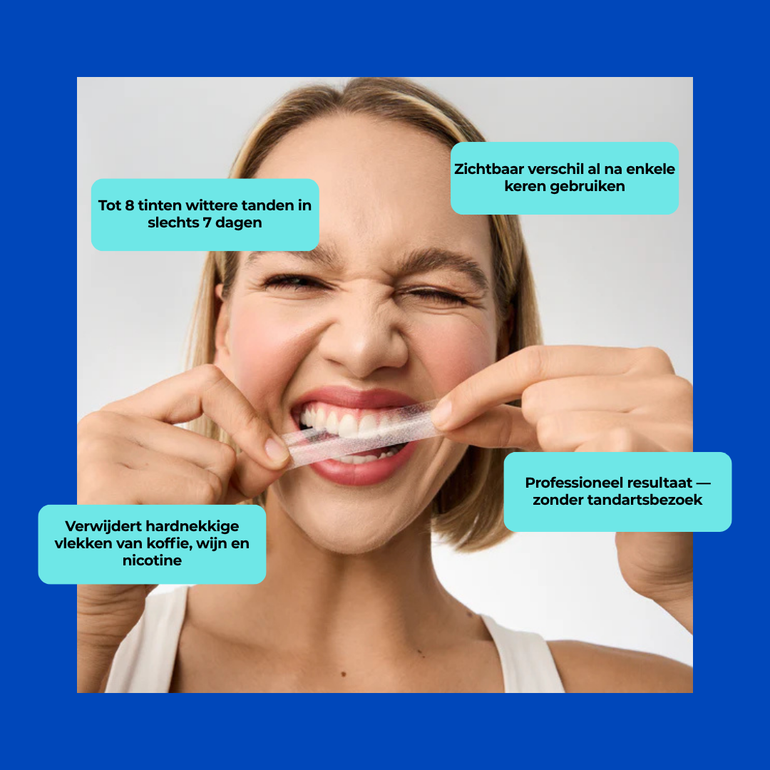 Stralende Glimlach Whitening Strips